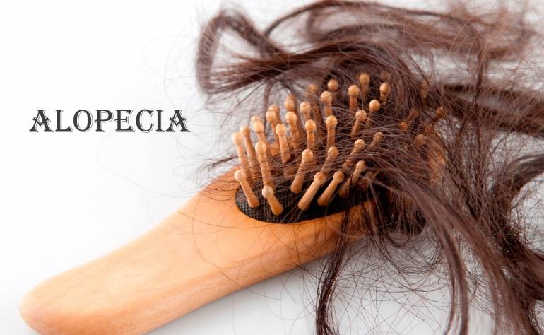 Кому лучше всего подходит PP405 для лечения алопеции: пол, возраст, генетика